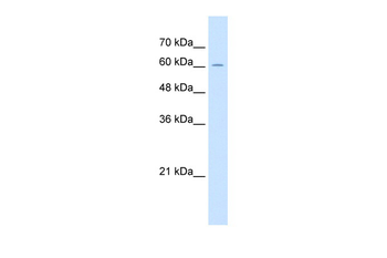 ZP2 Rabbit Polyclonal Antibody