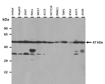 CHST1 Rabbit Polyclonal Antibody