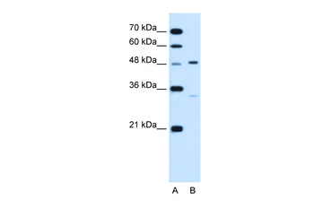 CHST1 Rabbit Polyclonal Antibody