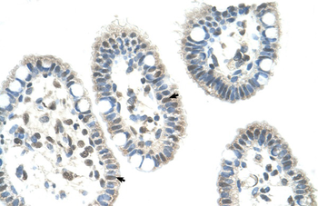 NR0B1 Rabbit Polyclonal Antibody