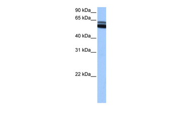 RARB Rabbit Polyclonal Antibody