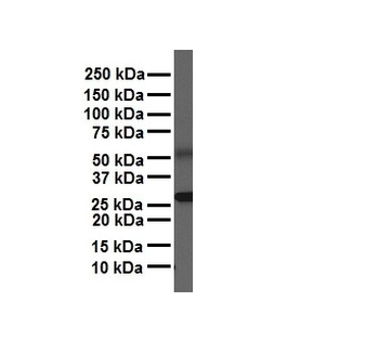 NR5A1 Rabbit Polyclonal Antibody