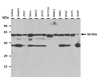 NR1H4 Rabbit Polyclonal Antibody