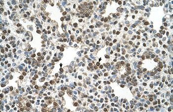 OSBPL9 Rabbit Polyclonal Antibody