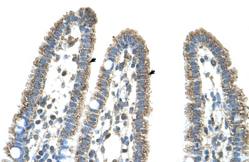CPS1 Rabbit Polyclonal Antibody