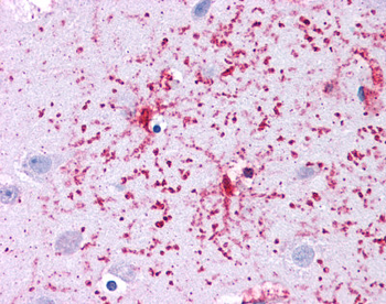 GLUD1 Rabbit Polyclonal Antibody