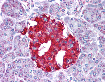 GLUD1 Rabbit Polyclonal Antibody