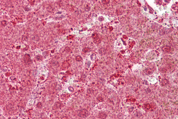 MST1 Rabbit Polyclonal Antibody