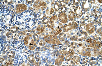 CSTB Rabbit Polyclonal Antibody
