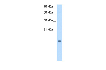 CSTB Rabbit Polyclonal Antibody