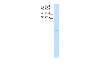 SOD1 Rabbit Polyclonal Antibody
