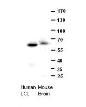 CCT8 Rabbit Polyclonal Antibody