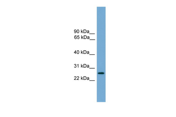 LRRC3 Rabbit Polyclonal Antibody