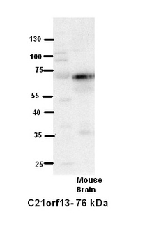 C21orf13 Rabbit Polyclonal Antibody
