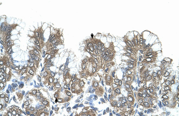 SNF1LK Rabbit Polyclonal Antibody