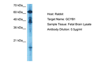 GUCY1B1 Rabbit Polyclonal Antibody