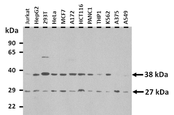 MTHFD2 Rabbit Polyclonal Antibody