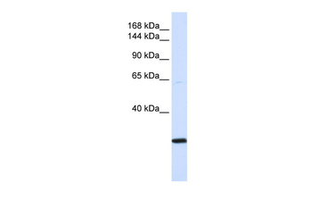 SMC2 Rabbit Polyclonal Antibody