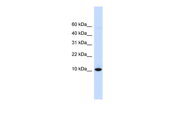 DDT Rabbit Polyclonal Antibody