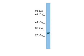 AK2 Rabbit Polyclonal Antibody