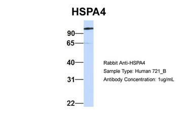 HSPA4 Rabbit Polyclonal Antibody