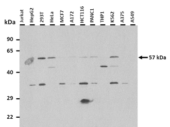 PPAT Rabbit Polyclonal Antibody