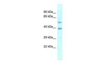 FEN1 Rabbit Polyclonal Antibody
