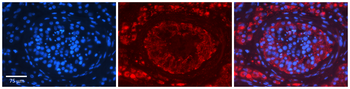 EPRS Rabbit Polyclonal Antibody