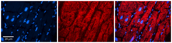 EPRS Rabbit Polyclonal Antibody