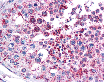 MAGEA3 Rabbit Polyclonal Antibody