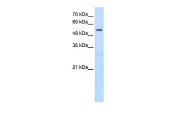 SHMT2 Rabbit Polyclonal Antibody
