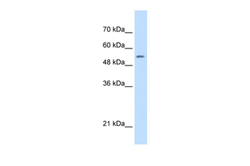 SHMT2 Rabbit Polyclonal Antibody