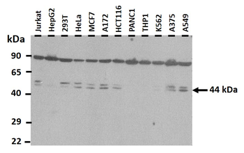 MAT2A Rabbit Polyclonal Antibody