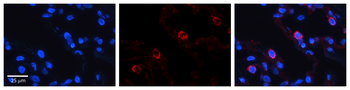 VARS Rabbit Polyclonal Antibody