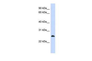 MRPL10 Rabbit Polyclonal Antibody
