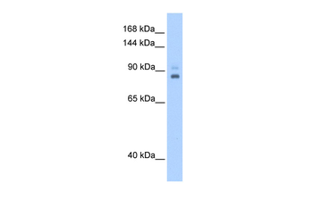 TPX2 Rabbit Polyclonal Antibody