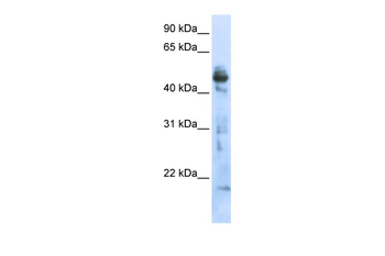 OXSM Rabbit Polyclonal Antibody