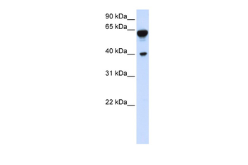 DTNB Rabbit Polyclonal Antibody