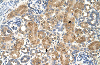 GPAA1 Rabbit Polyclonal Antibody