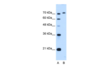 GPAA1 Rabbit Polyclonal Antibody
