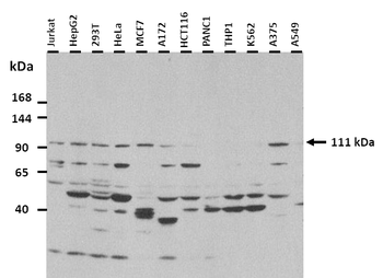 OSMR Rabbit Polyclonal Antibody