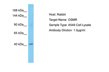 OSMR Rabbit Polyclonal Antibody