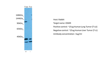 OSMR Rabbit Polyclonal Antibody