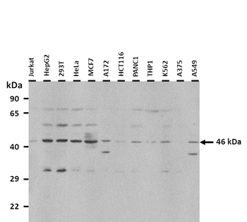 COX15 Rabbit Polyclonal Antibody