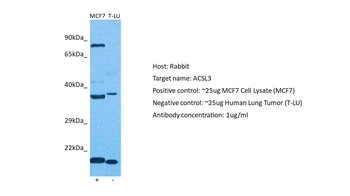 ACSL3 Rabbit Polyclonal Antibody