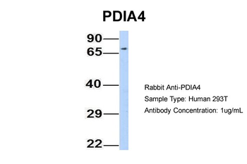 PDIA4 Rabbit Polyclonal Antibody