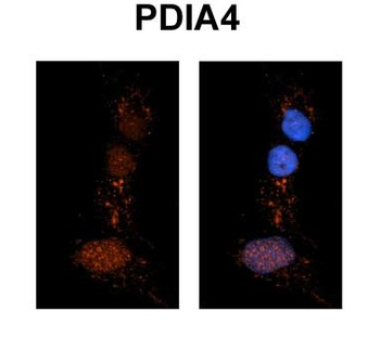 PDIA4 Rabbit Polyclonal Antibody