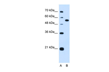 LMAN1 Rabbit Polyclonal Antibody