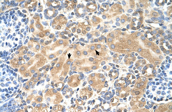 TSPAN5 Rabbit Polyclonal Antibody