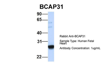 BCAP31 Rabbit Polyclonal Antibody
